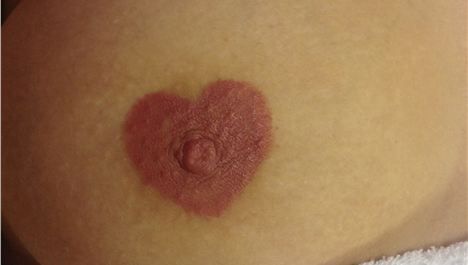 Why Do I Get Nipple Erections